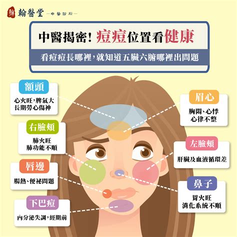 痘痘長得位置|額頭、下巴狂長痘痘？痘痘位置反映的健康問題與保養對策